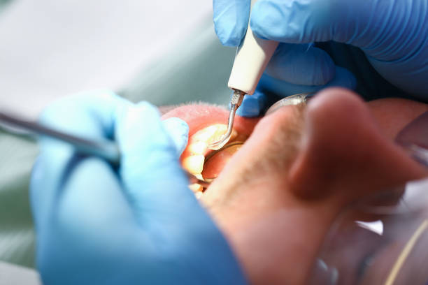 Best After-Hours Emergency Dentist in Keller, TX